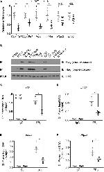 Estrogen Receptor beta Antibody in Immunoprecipitation (IP)