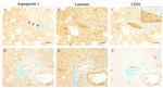 Aquaporin 1 Antibody in Immunohistochemistry, Immunohistochemistry (Paraffin) (IHC, IHC (P))