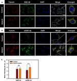 Phospho-GSK3B (Ser9) Antibody in Immunocytochemistry (ICC/IF)