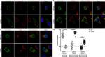 Lamin A/C Antibody in Immunocytochemistry (ICC/IF)