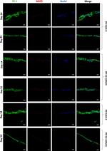 Mouse IgG (H+L) Cross-Adsorbed Secondary Antibody in Immunohistochemistry (PFA fixed) (IHC (PFA))