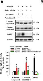 Rabbit IgG (H+L) Secondary Antibody in Western Blot (WB)