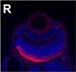 Mouse IgG2a Cross-Adsorbed Secondary Antibody in Immunohistochemistry (IHC)