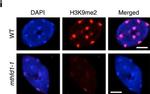 Mouse IgG (H+L) Highly Cross-Adsorbed Secondary Antibody in Immunocytochemistry (ICC/IF)