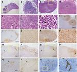 CD4 Antibody in Immunohistochemistry (IHC)