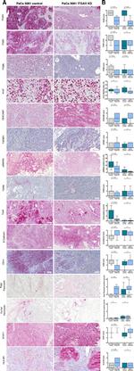 TGFBI Antibody in Immunohistochemistry (IHC)