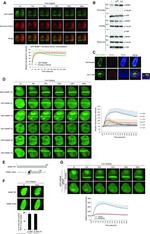 RPA2 Antibody in Immunocytochemistry (ICC/IF)