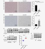 CD4 Antibody in Immunohistochemistry (IHC)