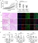 FOXP3 Antibody in Immunohistochemistry (IHC)