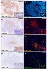 CD4 Antibody in Immunohistochemistry (IHC)