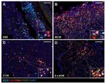 FOXP3 Antibody in Immunohistochemistry (IHC)