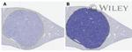 CD4 Antibody in Immunohistochemistry (IHC)