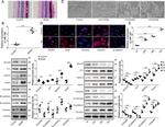 Snail1 Antibody in Western Blot, Immunocytochemistry (WB, ICC/IF)
