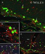 Connexin 26 Antibody in Immunohistochemistry (IHC)