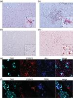 Factor XIII A Antibody in Immunohistochemistry (IHC)