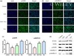 EGFR Antibody in Western Blot (WB)