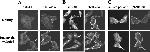 Calpastatin Antibody in Immunocytochemistry (ICC/IF)