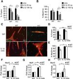 IL-1 beta Antibody in Neutralization (Neu)