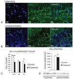 Estrogen Receptor alpha Antibody in Western Blot, Immunohistochemistry (WB, IHC)