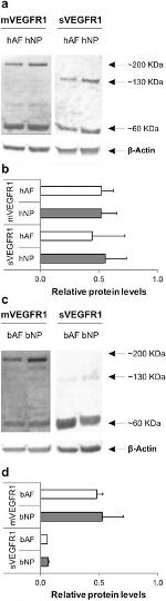 VEGF Receptor 1 (soluble) Antibody in Western Blot (WB)