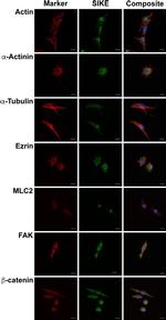 Ezrin Antibody in Immunocytochemistry (ICC/IF)