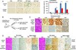 Chromogranin A Antibody in Immunohistochemistry (IHC)