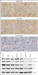 Btk Antibody in Immunohistochemistry (IHC)