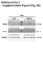 NCEH1 Antibody in Western Blot (WB)