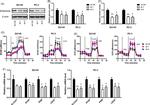 PRKAR2B Antibody in Western Blot (WB)