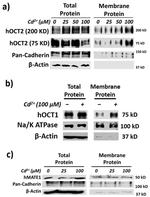 SLC22A1 Antibody in Western Blot (WB)