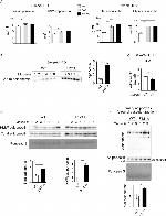 Adiponectin Antibody in Western Blot (WB)