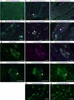 SMPX Antibody in Immunohistochemistry (IHC)