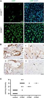 VWF Antibody in Immunocytochemistry (ICC/IF)