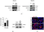 Calbindin D28K Antibody in Western Blot (WB)