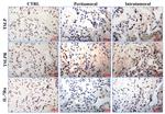 TSLP Antibody in Immunohistochemistry (IHC)