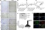 NFATC1 Antibody in Western Blot, Immunohistochemistry (WB, IHC)