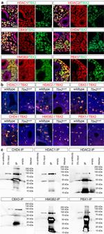 HDAC1 Antibody in Immunocytochemistry, Immunohistochemistry (Paraffin) (ICC/IF, IHC (P))