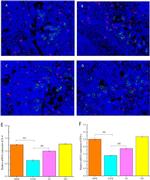 CD4 Antibody in Immunohistochemistry (Paraffin) (IHC (P))