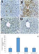 p53 Antibody in Immunohistochemistry (IHC)