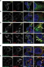 Rabbit IgG (H+L) Highly Cross-Adsorbed Secondary Antibody in Immunocytochemistry (ICC/IF)