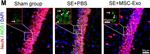 Goat IgG (H+L) Cross-Adsorbed Secondary Antibody in Immunohistochemistry (IHC)