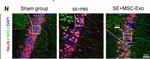 Mouse IgG (H+L) Highly Cross-Adsorbed Secondary Antibody in Immunohistochemistry (IHC)