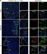 Goat IgG (H+L) Cross-Adsorbed Secondary Antibody in Immunohistochemistry (IHC)