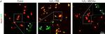 Rabbit IgG (H+L) Highly Cross-Adsorbed Secondary Antibody in Immunohistochemistry (IHC)