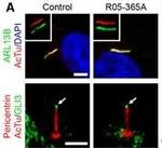 Rabbit IgG (H+L) Highly Cross-Adsorbed Secondary Antibody in Immunohistochemistry (IHC)