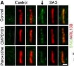 Rabbit IgG (H+L) Highly Cross-Adsorbed Secondary Antibody in Immunohistochemistry (IHC)