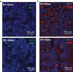 Rat IgG (H+L) Cross-Adsorbed Secondary Antibody in Immunohistochemistry (IHC)