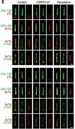 Goat IgG (H+L) Cross-Adsorbed Secondary Antibody in Immunohistochemistry (IHC)