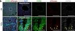 Goat IgG (H+L) Cross-Adsorbed Secondary Antibody in Immunohistochemistry (IHC)