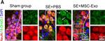 Goat IgG (H+L) Cross-Adsorbed Secondary Antibody in Immunohistochemistry (IHC)